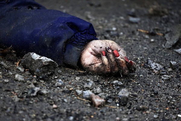 러시아군의 무자비한 총격으로 손톱에 매니큐어를 칠한 여성이 길에 쓰러져 있다. 사진=NEW DPRK