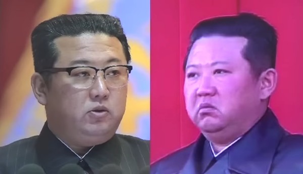 김정은 북한 국무위원장의 수술 전후 사진. 사진=시사주간 DB