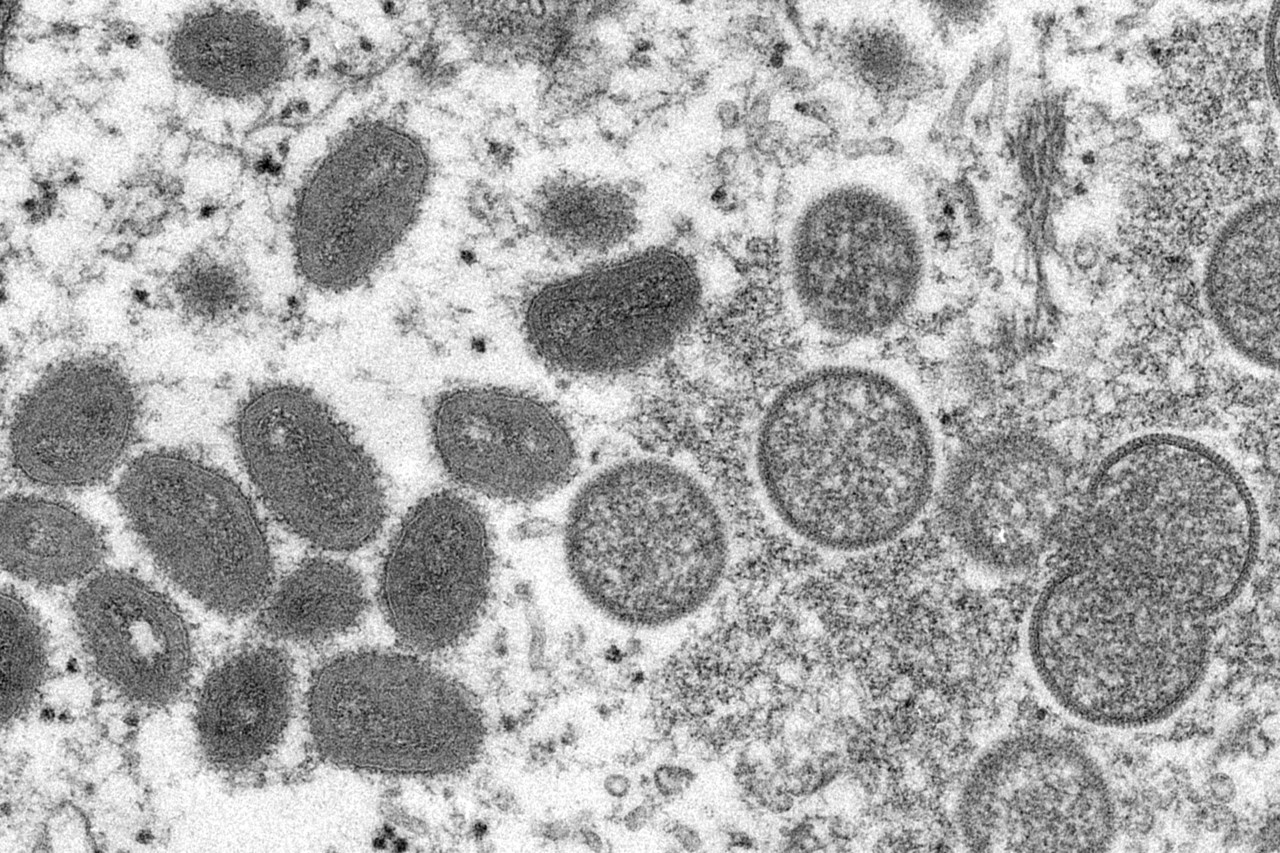 미국 질병통제예방센터가 공개한 원숭이두창 바이러스